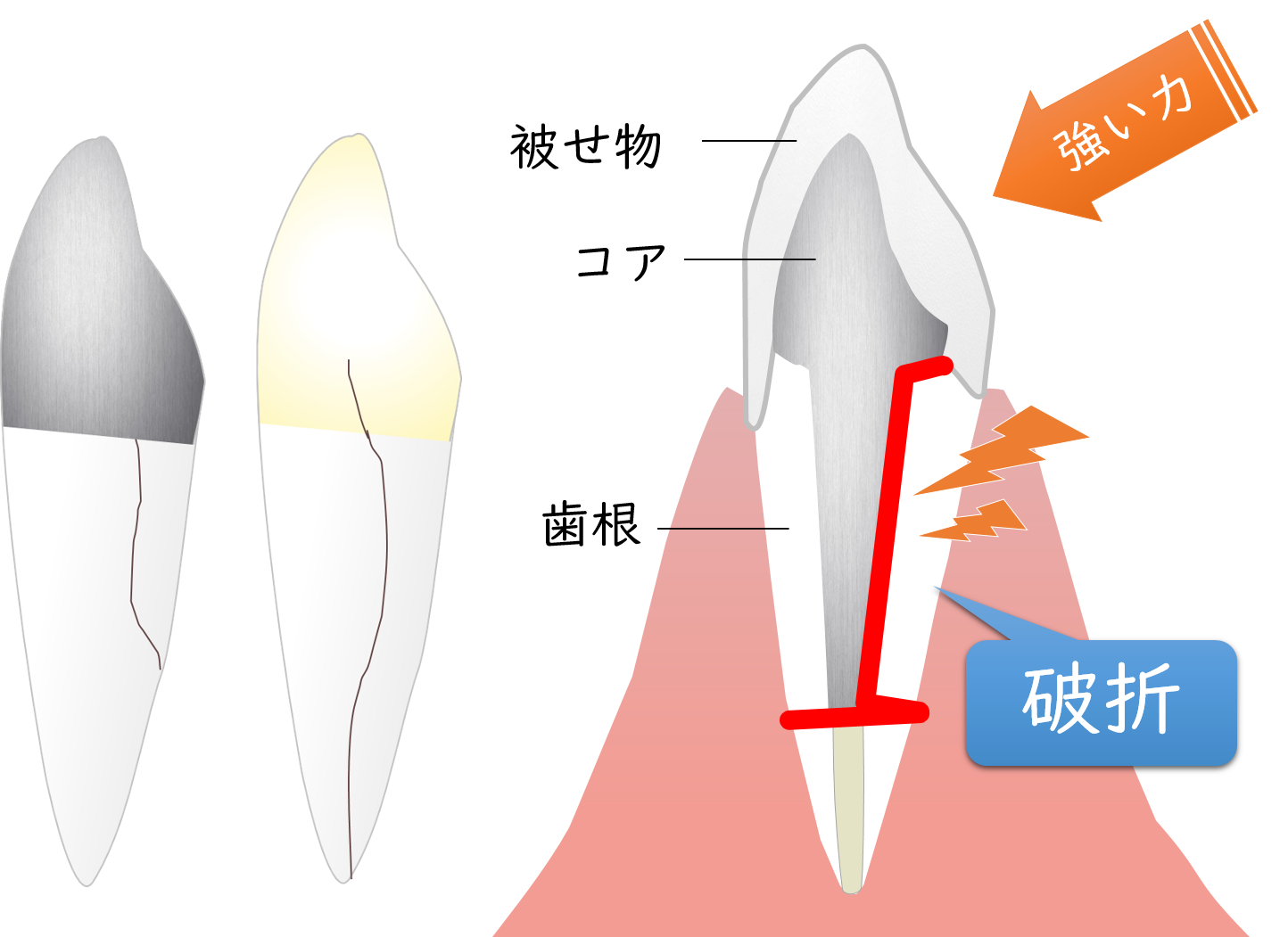 戸塚区（舞岡）の歯医者、まいおか町歯科の歯科用ＣＴ